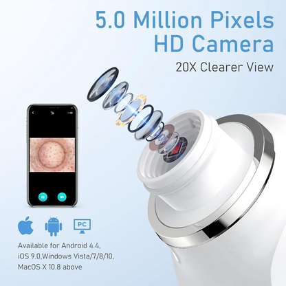 Pore Cleaner C503 Wifi Smart High Definition Visual